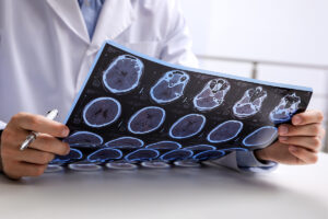 How Does Your Doctor Determine the Severity of a Traumatic Brain Injury-Img