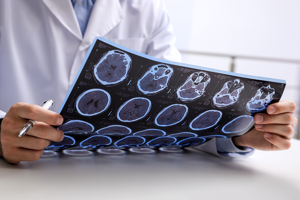 How Does Your Doctor Determine the Severity of a Traumatic Brain Injury ...